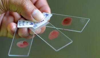 Febră dengue şi malarie: Bolile dispărute încep să reapară în Europa