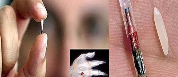 Imagini şocante! Microcipuri implantate: control total